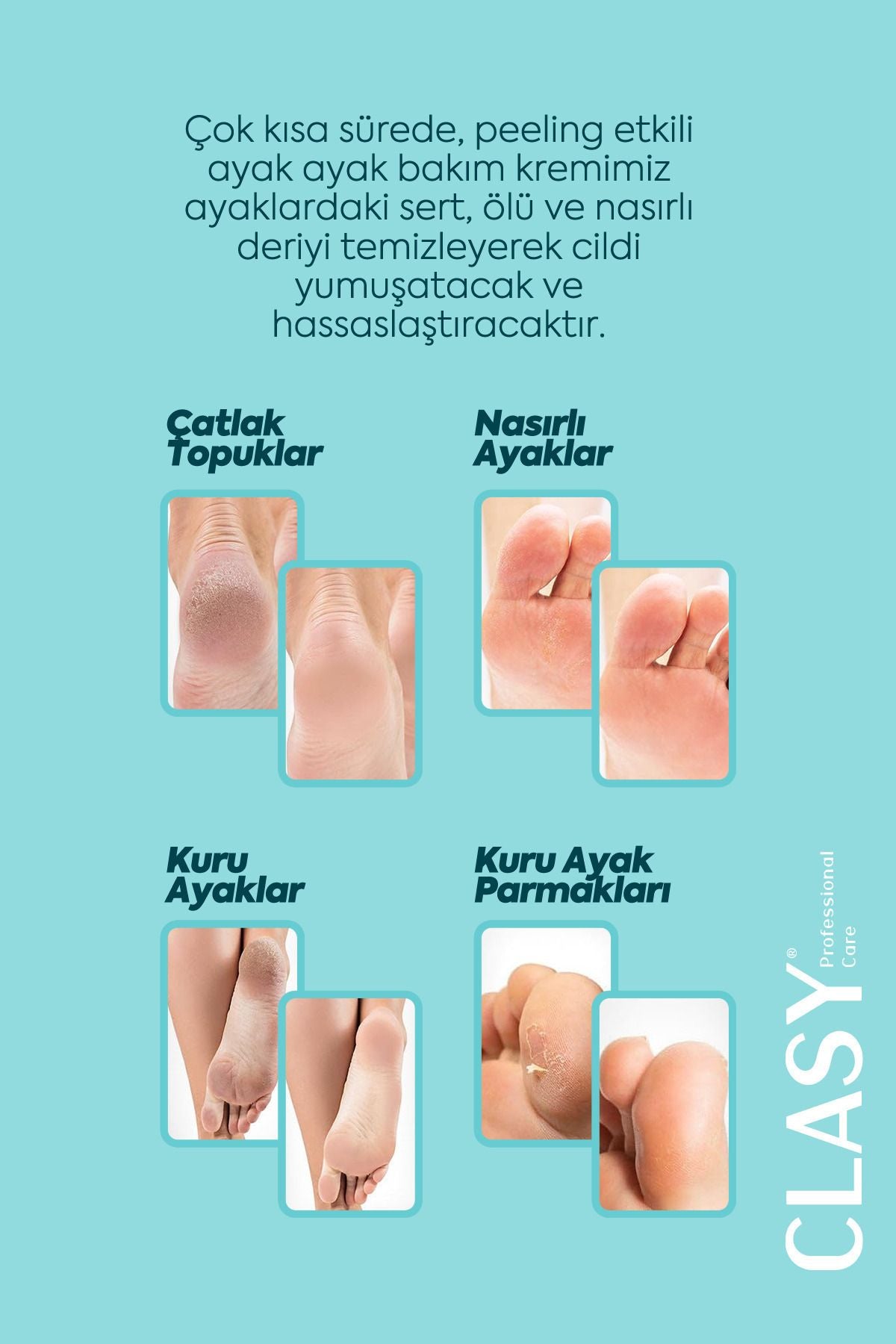 Çatlak Onarıcı Topuk Kremi