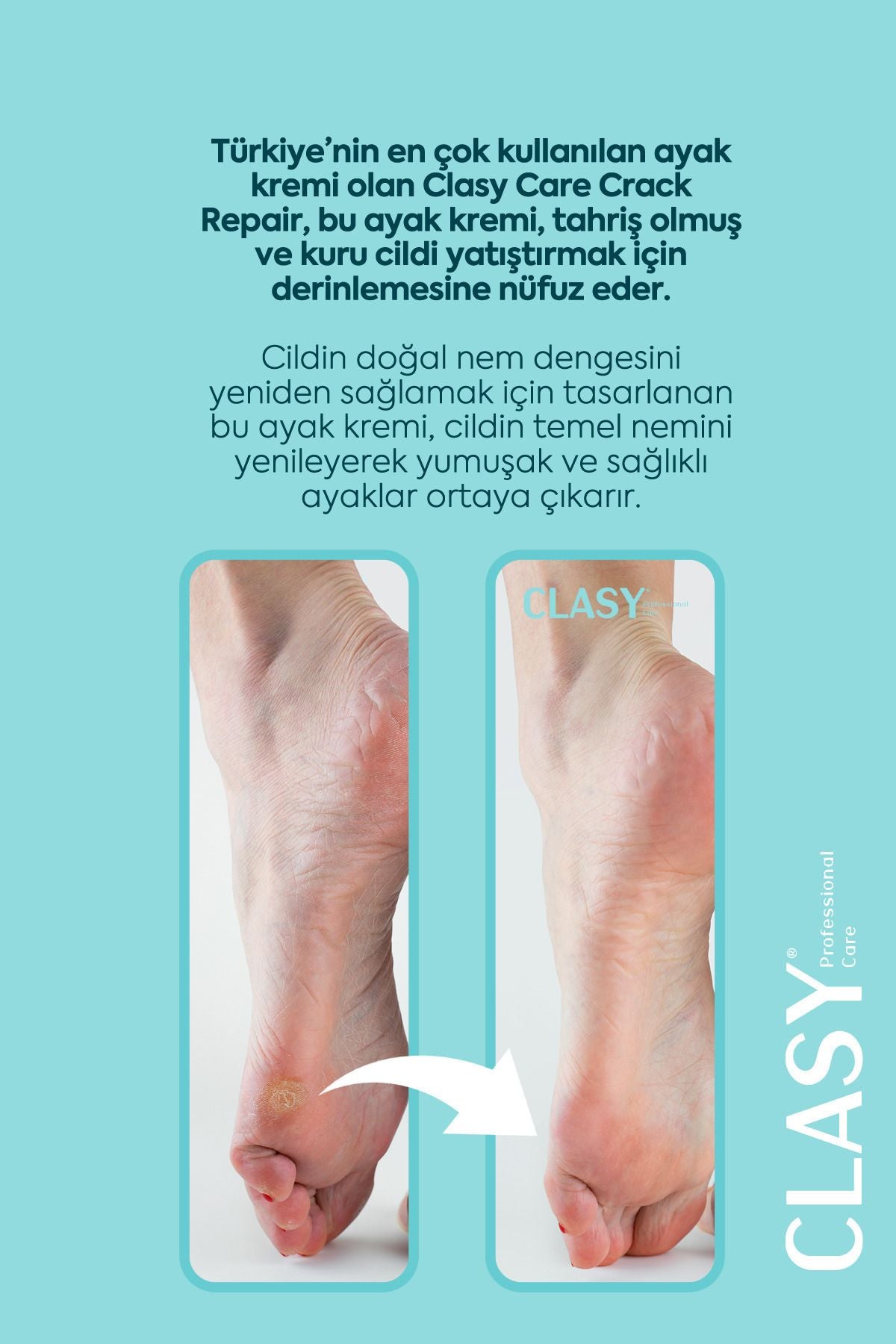 Çatlak Onarıcı Topuk Kremi